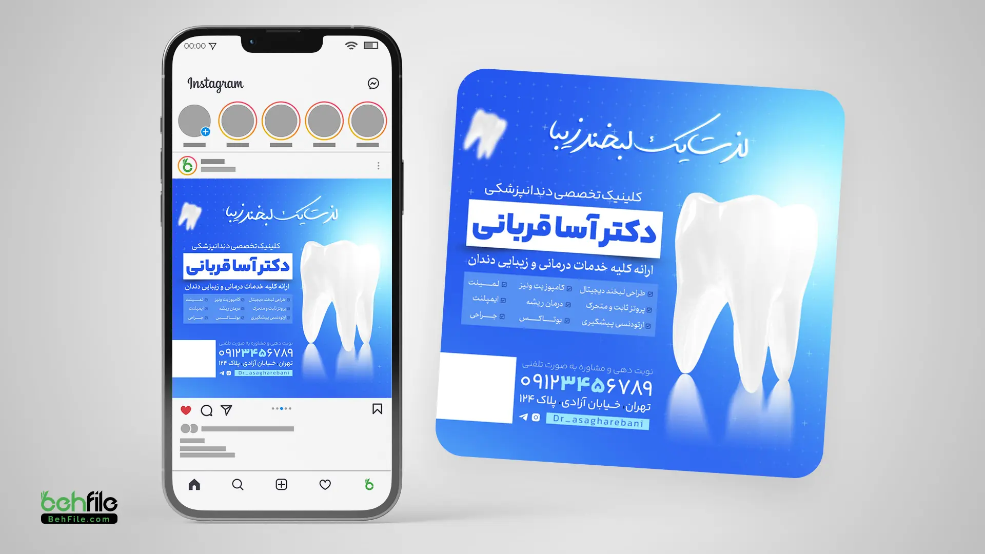 طرح لایه‌باز پست اینستاگرام معرفی خدمات دندانپزشکی