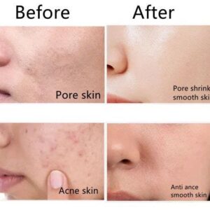 فوم شستشوی صورت زهر مار EXGYAN ضد چروک و آبرسان