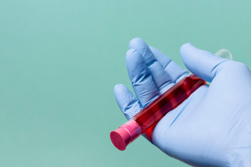 آزمایشات قبل از عمل اسلیو با انجام یکسری آزمایشات قبل از عمل اسلیو معده، پزشک شرایط فرد برای عمل را بررسی می کند.