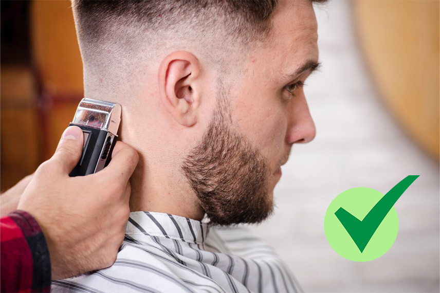 ایا برای کاشت مو باید کچل کرد؟