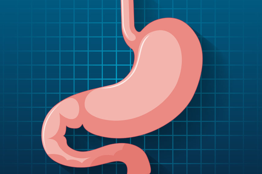 عمل اسلیو در عمل اسلیو معده، سایز معده بین 70 الی 80 درصد کوچکتر از اندازه اصلی خود میشود .