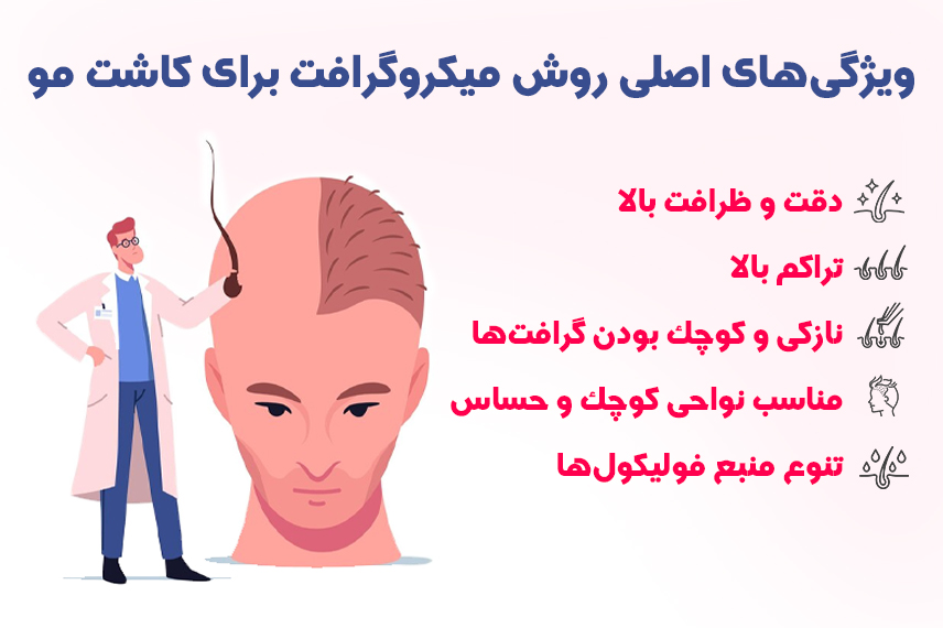 کاشت مو میکروگرافت ویژگی های روش کاشت مو میکروگرافت