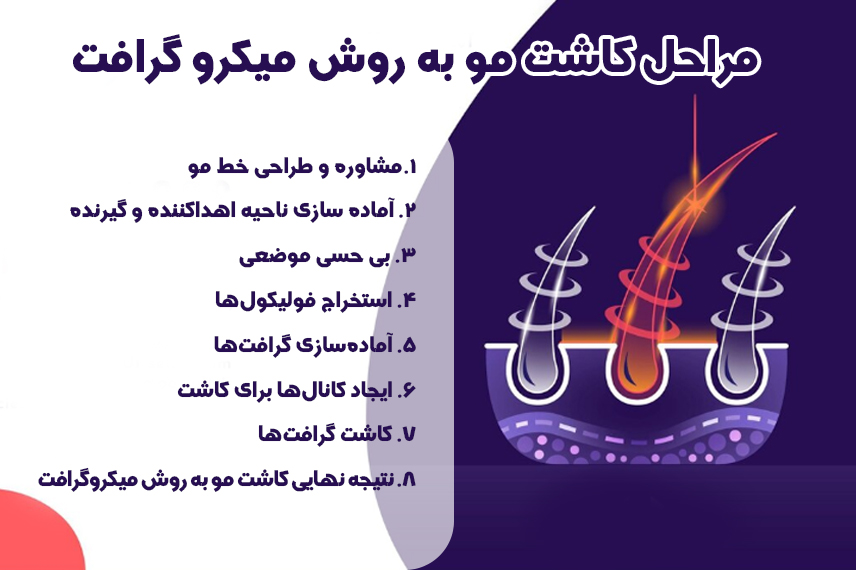 مراحل میکروگرافت مراحل کاشت مو به روش میکروگرافت