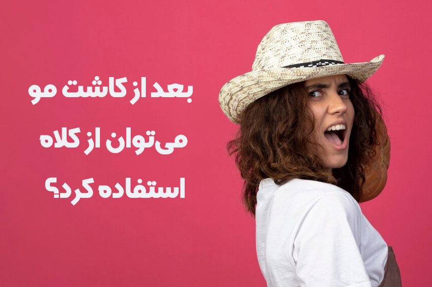 استفاده از کلاه بعد از کاشت مو